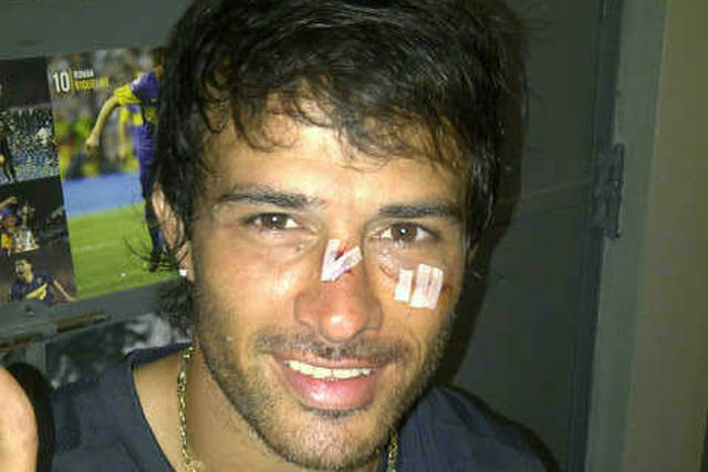 Imagen
