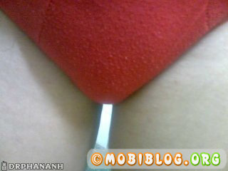 © Mobiblog.Org