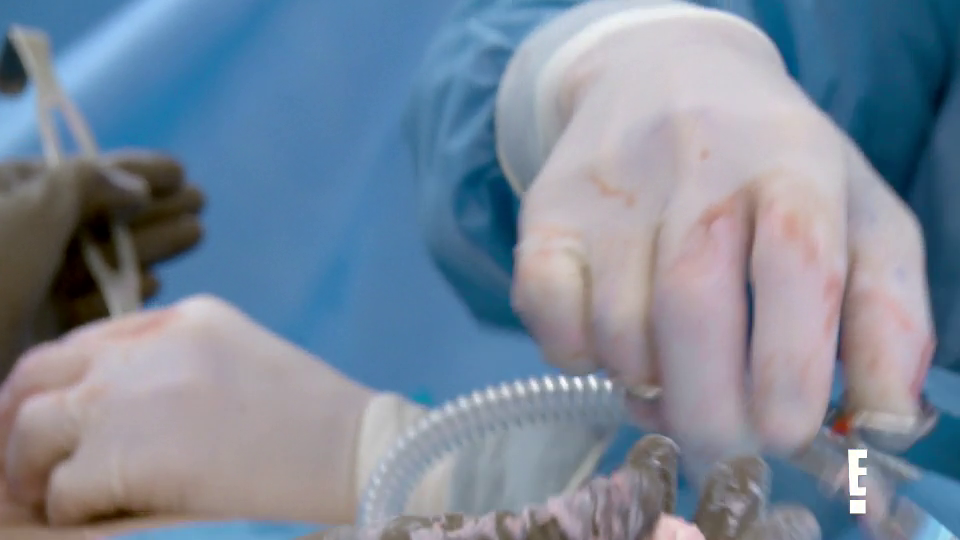 Botched S05E01 WEB x264-TBS Botched S05E01 WEB x264-TBS