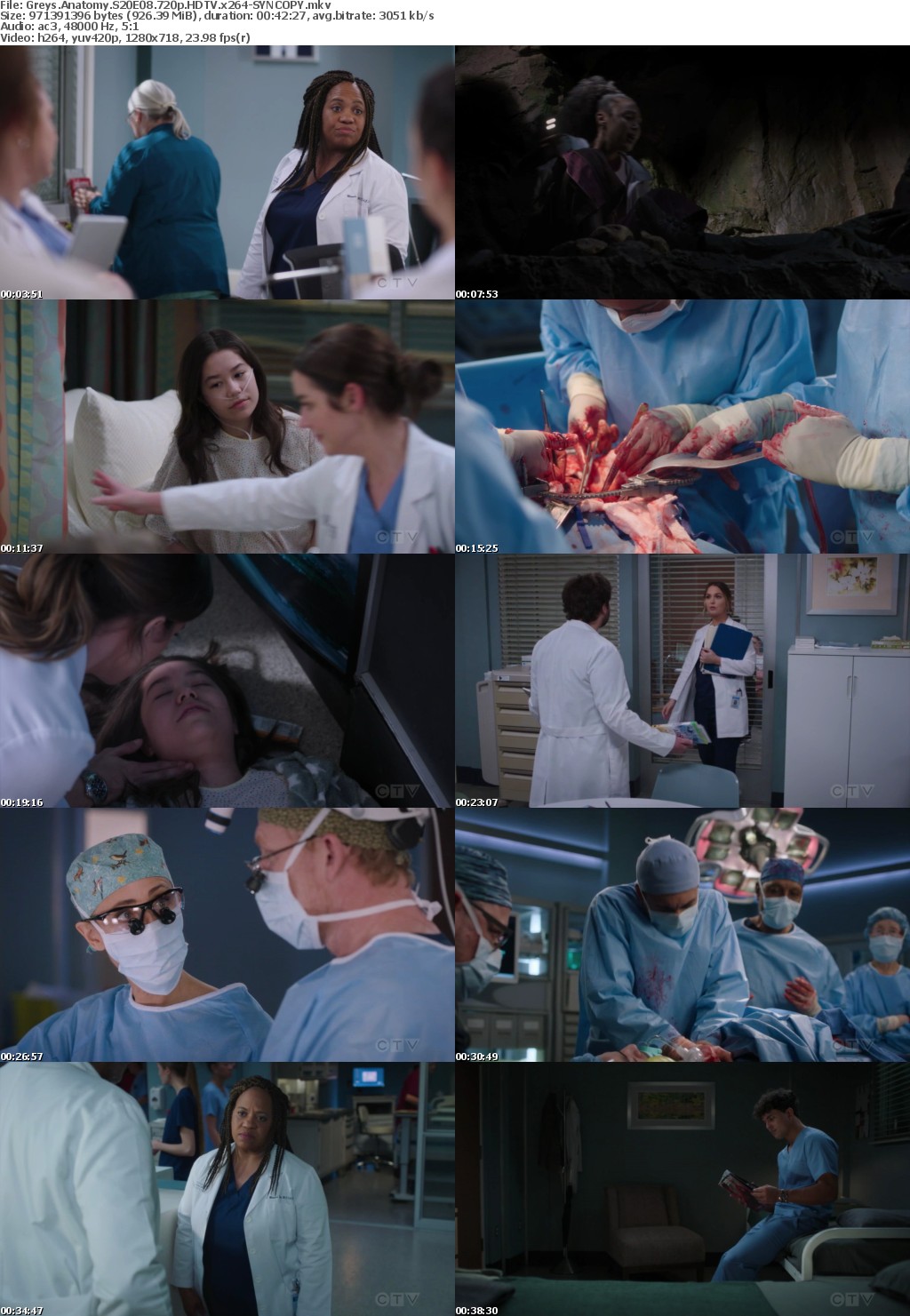 Greys Anatomy S20E08 720p HDTV x264-SYNCOPY